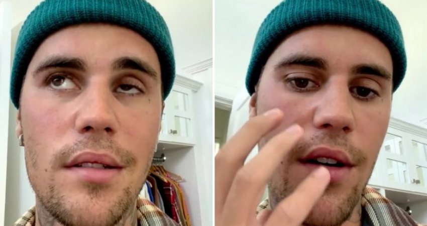 A ka lidhje paraliza e fytyrës së Justin Bieber me vaksinën anti-COVID?