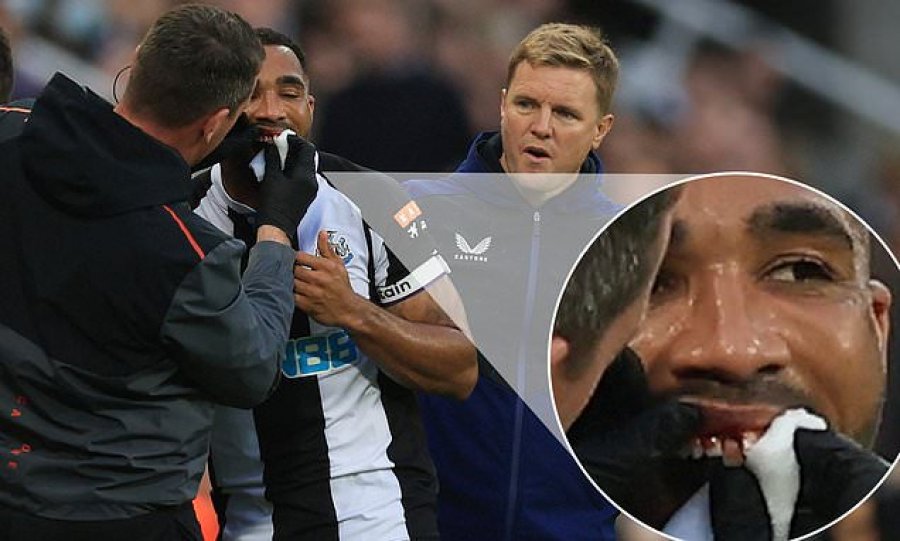 VIDEO/ Sulmuesi i Newcastle humbi dhëmbin gjatë ndeshjes kundër Arsenalit