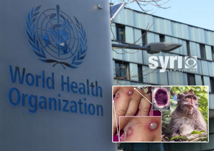 ‘Lija e Majmunëve’/ OBSH: Nuk pritet të çojë në pandemi globale 