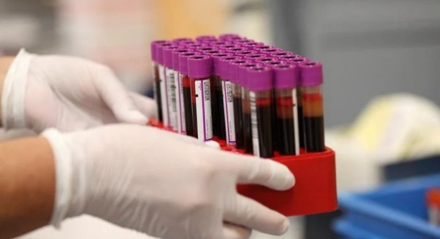 Një testi i ri gjaku zbulon mbi 50 lloje kanceri