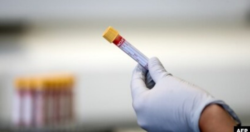 Një test i ri gjaku zbulon mbi 50 lloje kanceri