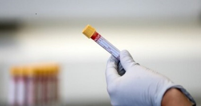 Ky test i ri gjaku zbulon mbi 50 lloje kanceri