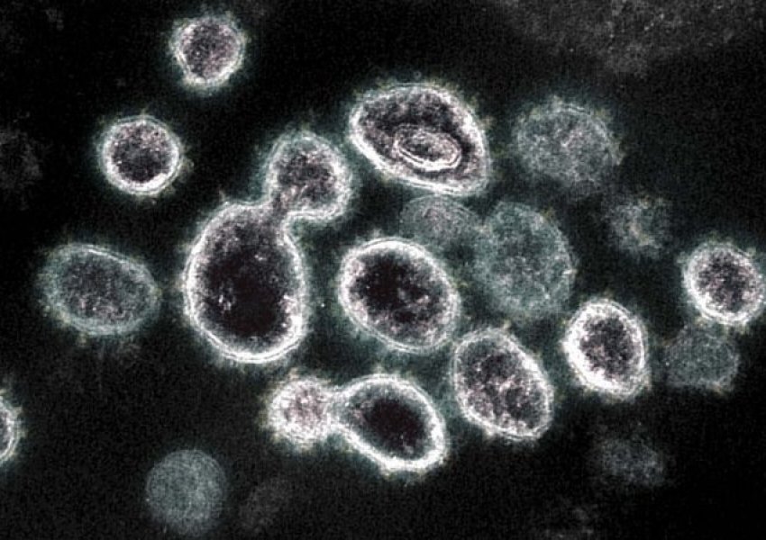 Versioni laboratorik i virusit Covid-19 ndez polemika