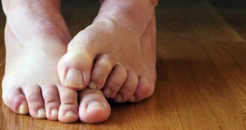 ?Simptomat e diabetit: Si këmbët tuaja mund të tregojnë sheqer të lartë në gjak