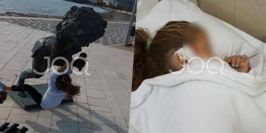 Vajzës së vogël në Durrës i bie sipër statuja gjysmë e thyer, pëson dëmtime në kokë 