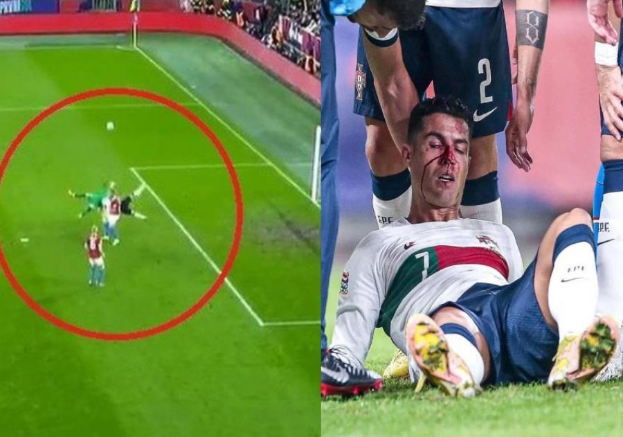 VIDEO/ Portieri i Çekisë nokauton Ronaldon, portugezi dëmtohet keq në hundë
