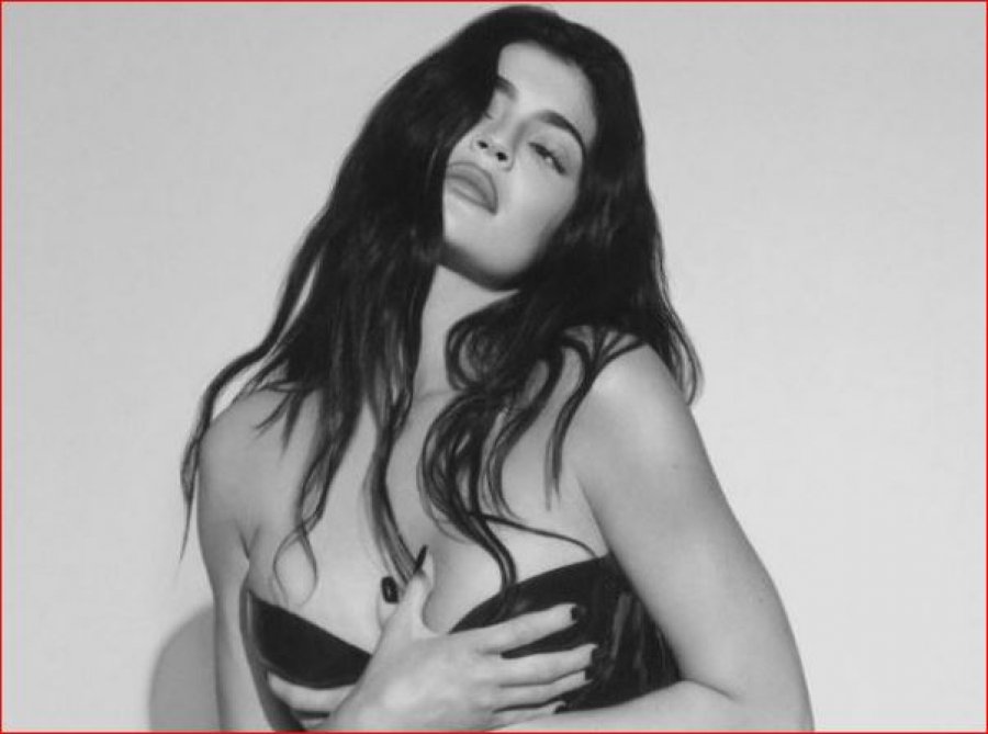 E kanë akuzuar gjithmonë për operacionet plastike, Kylie Jenner flet pa ‘doreza’ dhe pranon se çfarë ndërhyrjesh ka bërë