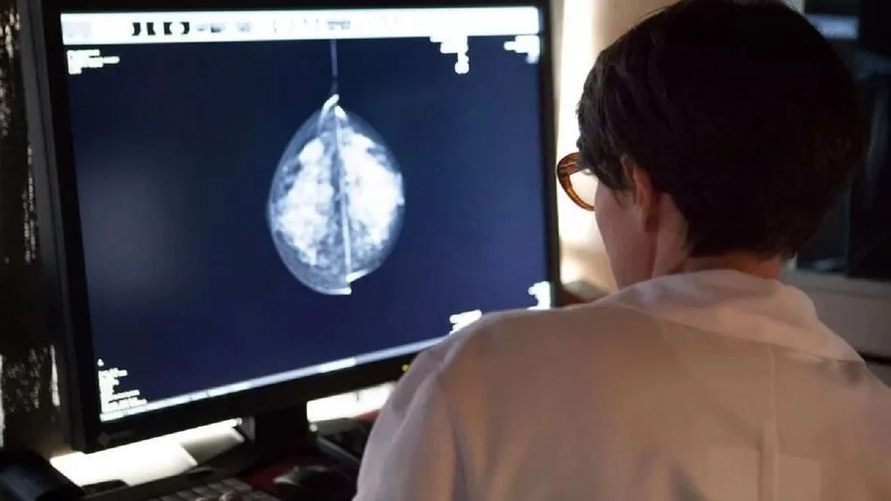 Zbulohet studimi: Inteligjenca artificiale ekzaminuesi më korrekt i kancerit të gjirit