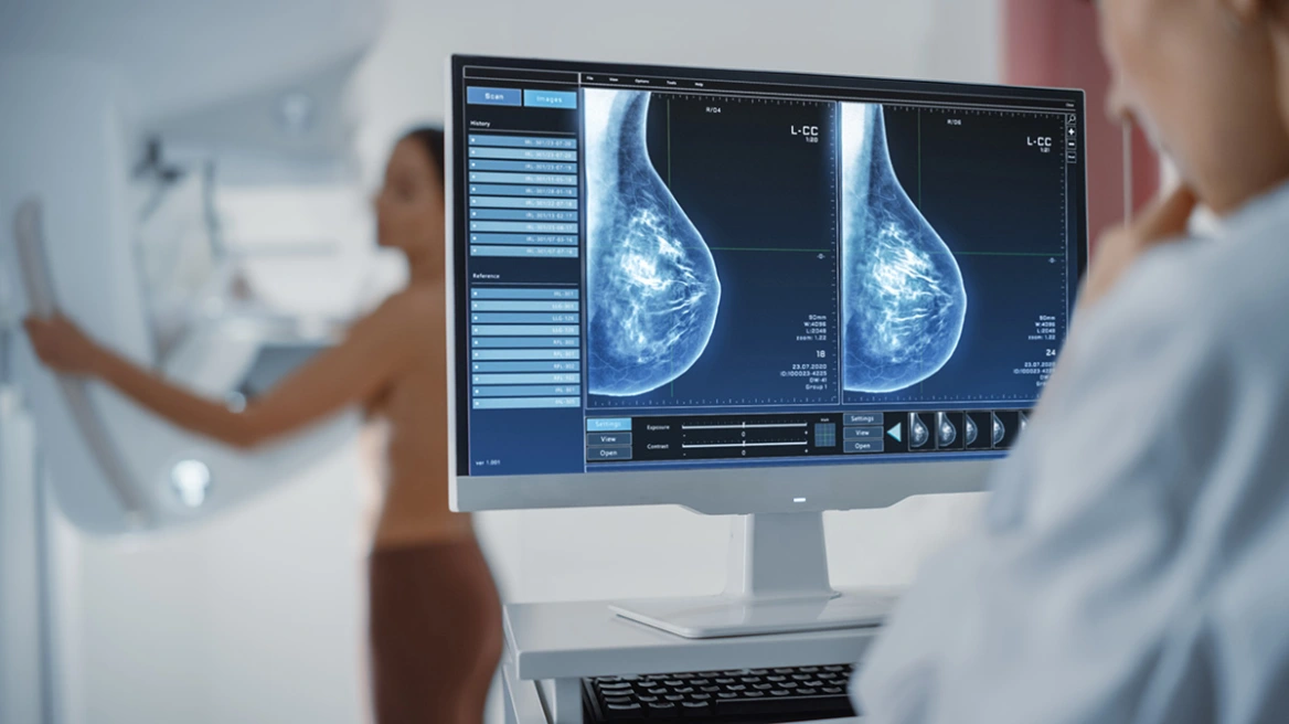 Përdorimi i inteligjencës artificiale në zbulimin e kancerit të gjirit i sigurt dhe i shpejt sa dy radiologë