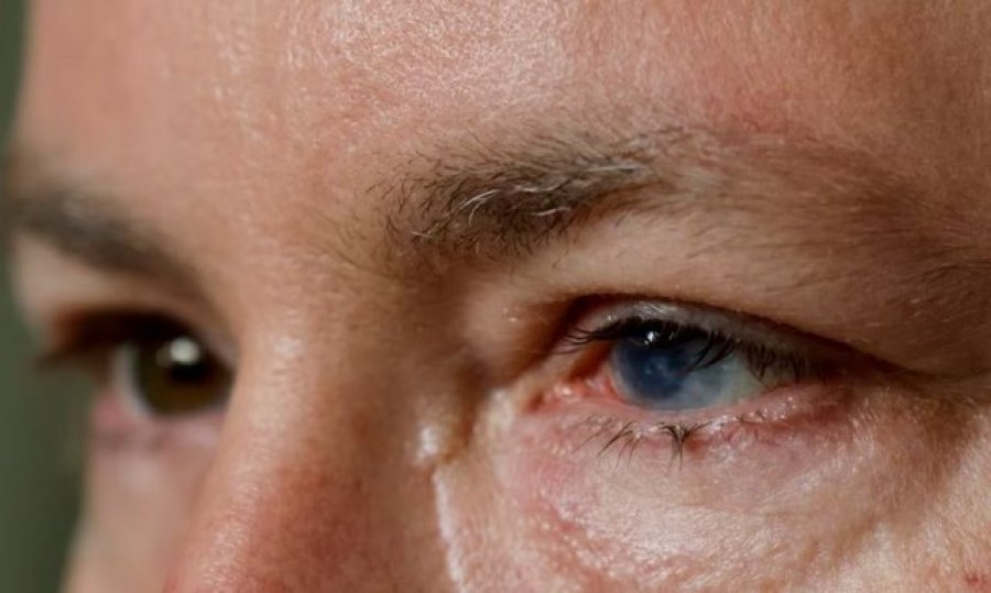 Qelizat embrionale të njërit sy mund të shërojnë syrin e dëmtuar