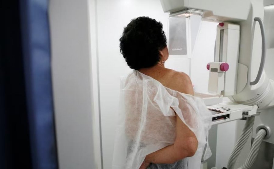 Suedi: Inteligjenca Artificiale ndihmon në zbulimin e kancerit të gjirit