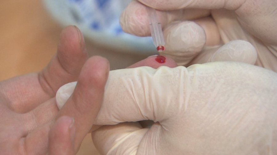 HIV/AIDS në Shqipëri, 113 raste të reja, mungon kapja në kohë e të prekurve nga mjekët
