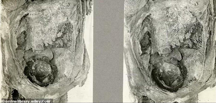 Zbulim tronditës nga arkeologët, gjejnë kokën e foshnjës në legenin e një nënë adoleshente