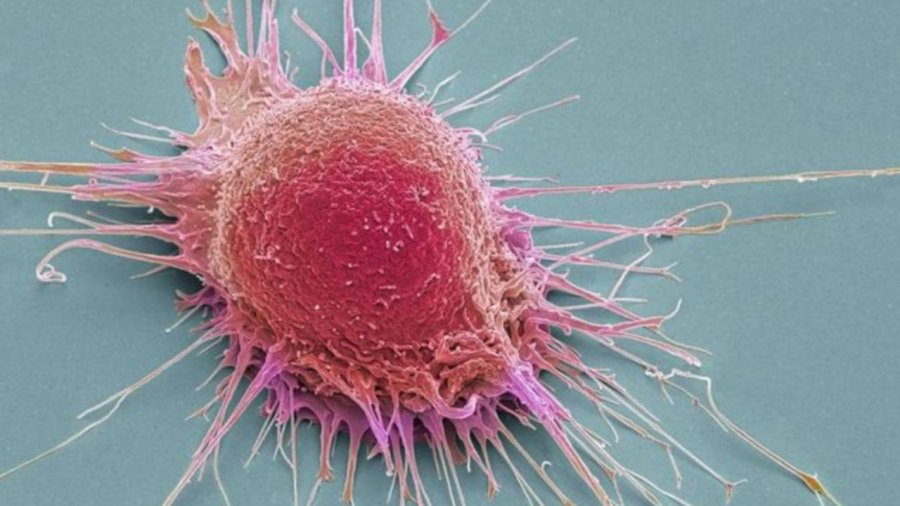 Harvardi zbulon terapinë e re kundër kancerit