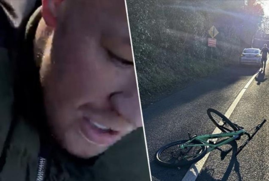 Ngjarje e rëndë/ Po udhëtonte me biçikletë, Conor McGregor përplaset nga një makinë