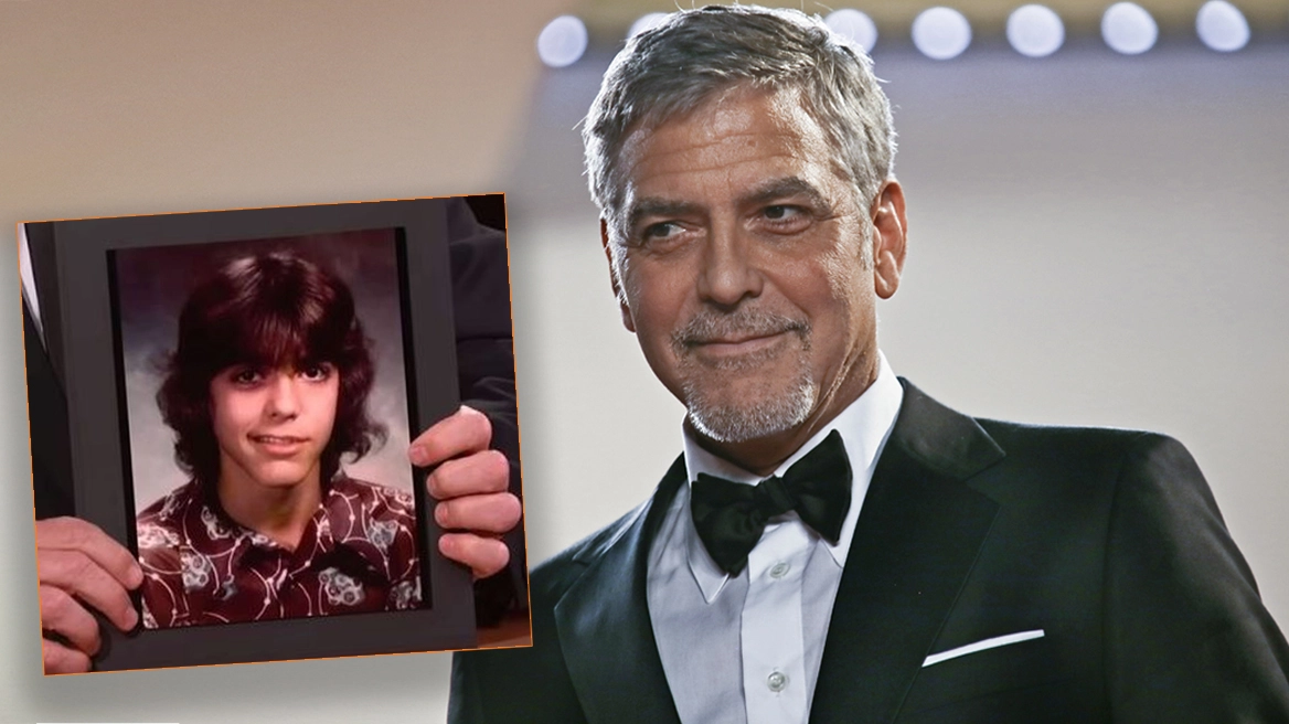 George Clooney zbulon problemin shëndetësor që i paralizoi gjysmën e fytyrës