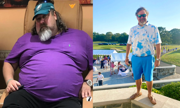 59-vjeçari që humbi 110 kilogramë brenda dy viteve