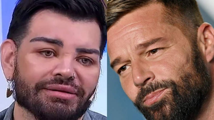 Fansi i Ricky Martin i nënshtrohet 40 operacioneve estetike për t'u dukur si idhulli i tij