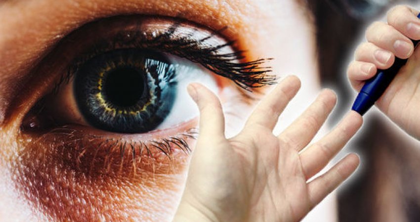 Shenjat e fshehura paralajmëruese të diabetit që prekin sytë