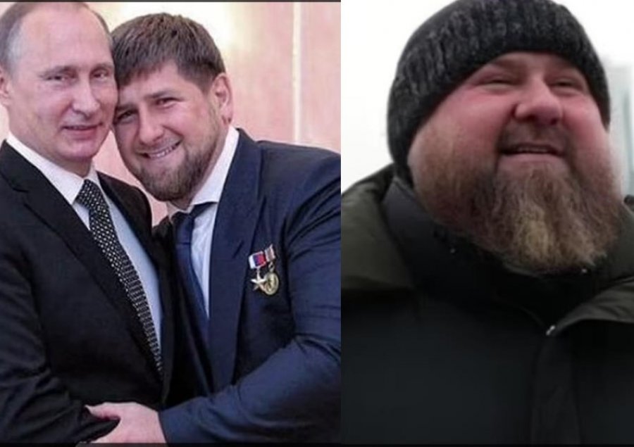 Aleati i Putinit, Razman Kadyrov i sëmurë rëndë, frikë për helmim