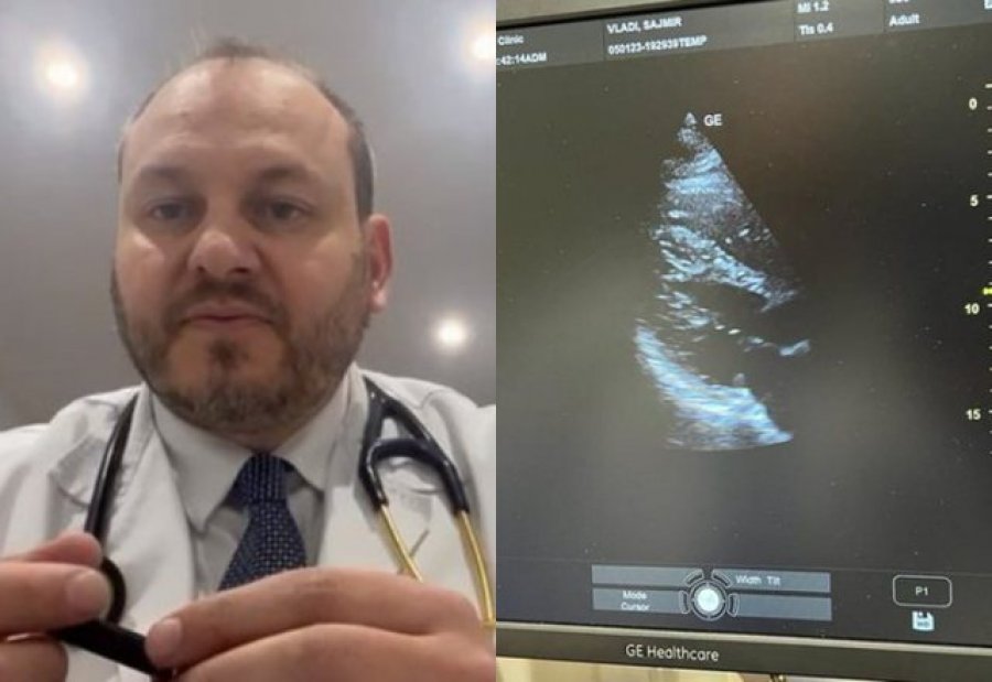 Zbulohet rasti i rrallë në Londër, 29-vjeçari shqiptar e ka zemrën në krahun e djathtë