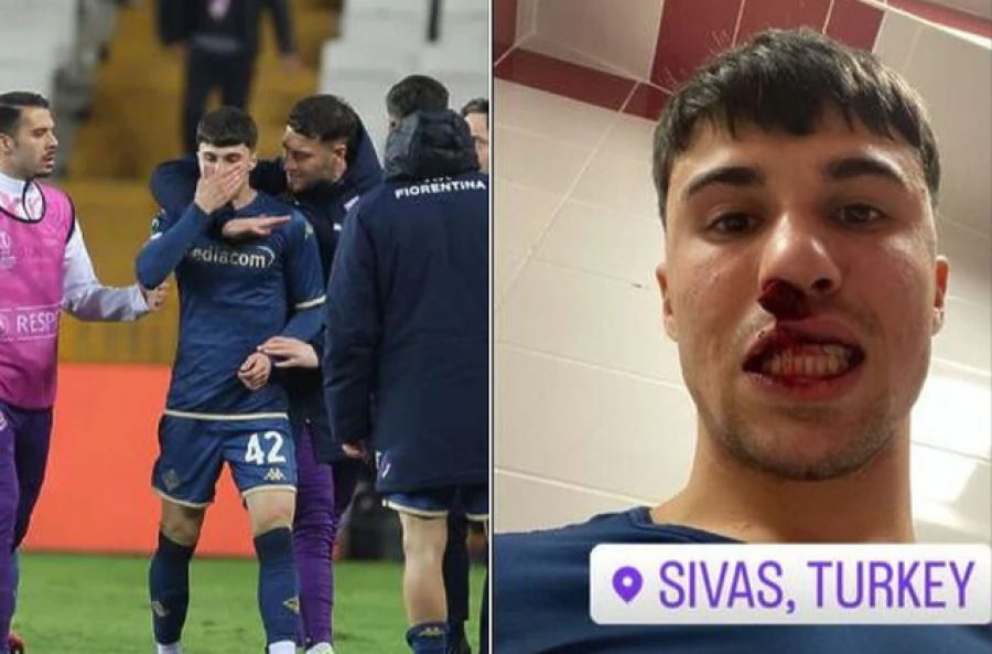 VIDEO/ Një tifoz në Turqi hyri në fushë dhe nokautoi lojtarin e Fiorentinës, i shkaktoi lëndime të rënda