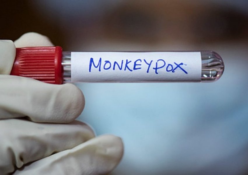 OBSH shpalli fundin e epidemisë së lijës së majmunit