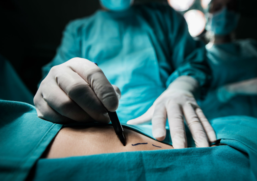 Zona më e rrezikshme për të kryer operacione plastike, paralajmërojnë kirurgët