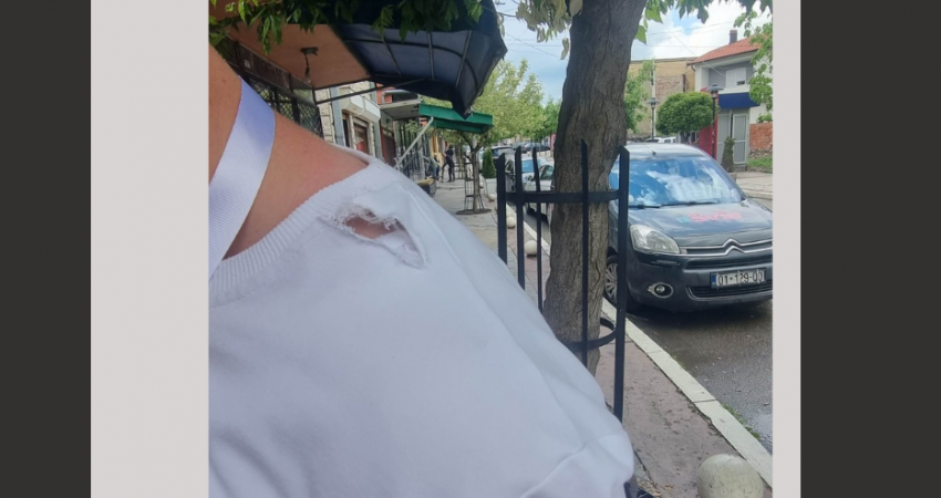 Sulmohet gazetari, serbët e tërbuar ia shqyejnë bluzën
