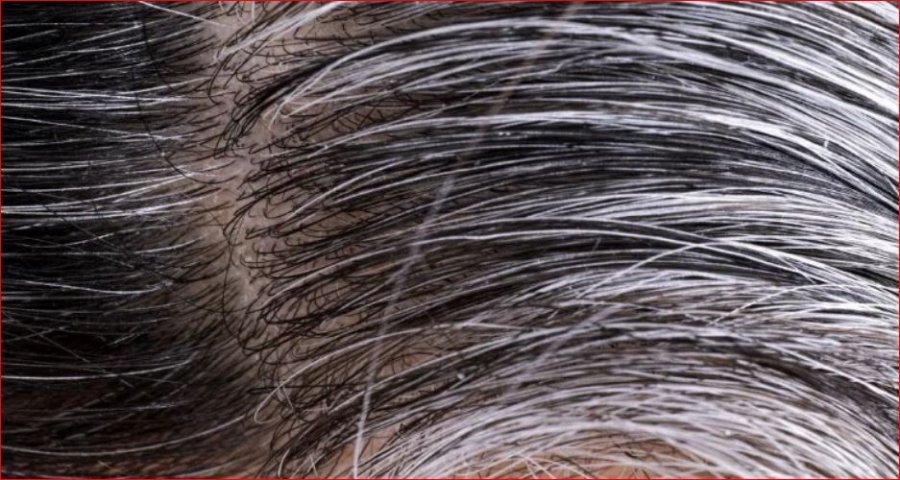 Thinja e parakohshme e flokëve, disa prej faktorëve që ndikojnë