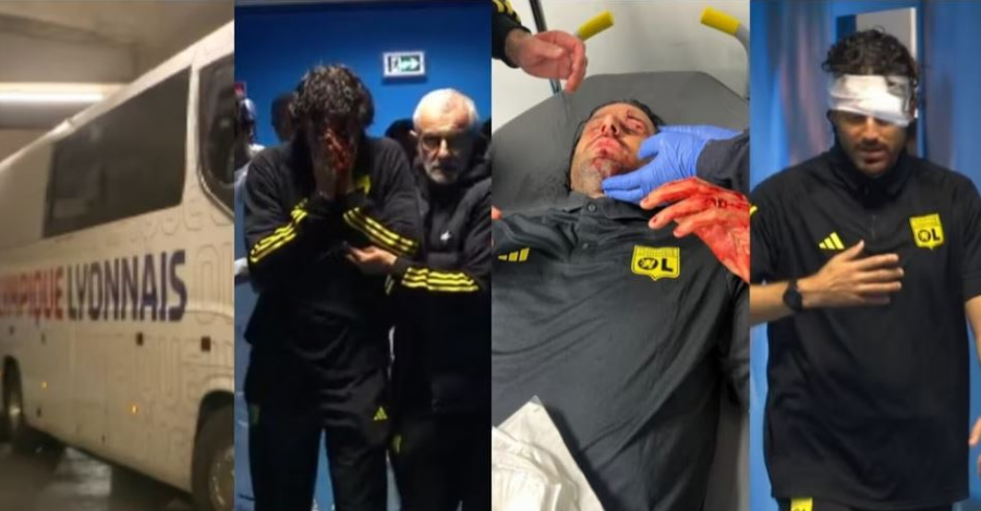 U plagos nga tifozët e Marseille, reagon trajneri Fabio Grosso: Mund të kishte ndodhur një tragjedi
