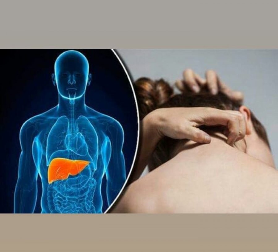 Simptomat kryesore që tregojnë problemet me mëlçinë