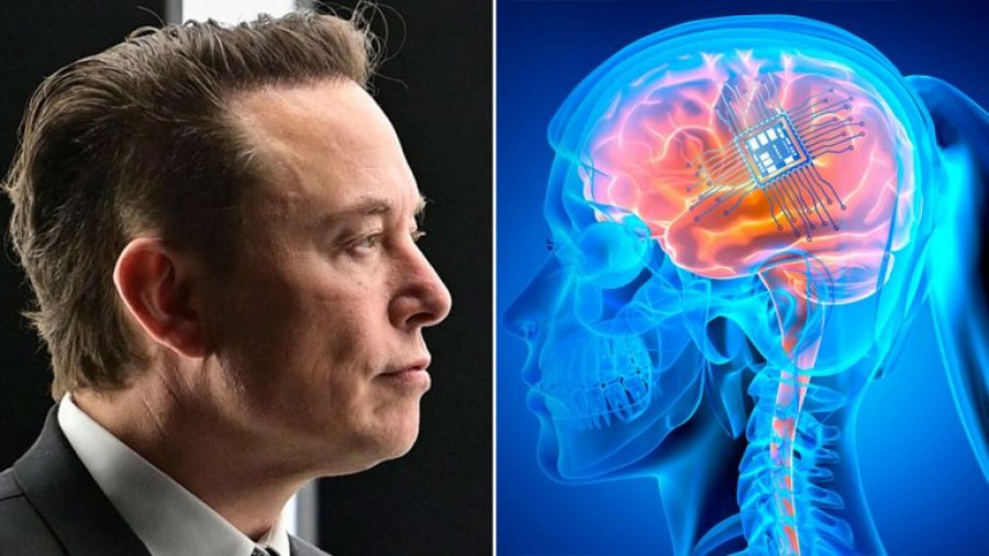 ‘Synon të ndihmojë pacientët e paralizuar’, kompanisë ‘Neuralink’ të Elon Musk i jepet ‘drita jeshile’ për të testuar implantet në trurin e njerëzve