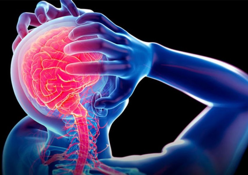 Metodat që duhet të dini – Si të pushoni dhimbjen e kokës pa Ilaçe