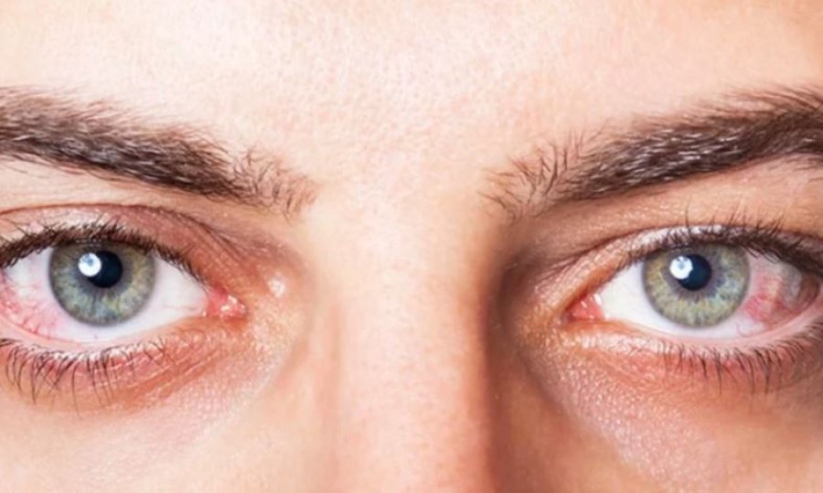 Cilat janë vitaminat më të mira për shëndetin e syve?