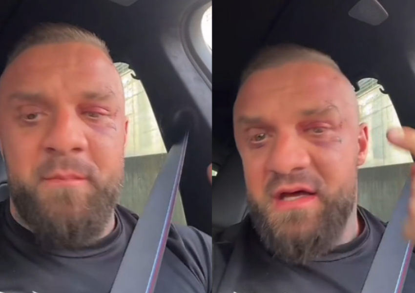 'Paratë e koncertit...'/ Me sy të nxirë dhe plagë në fytyrë, Medi Iseni publikon video për herë të parë pas sherrit me Noizy-n