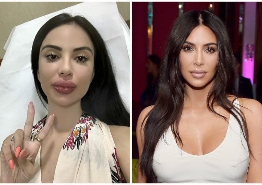 Donte të dukej si Kim Kardashian! E reja merr lajmin rrëqethës