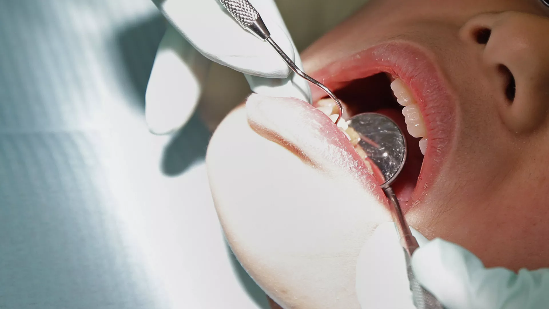 Politikë e BE: Ligjvënësit bien dakord të ndalojnë merkurin në mbushjen e dhëmbëve