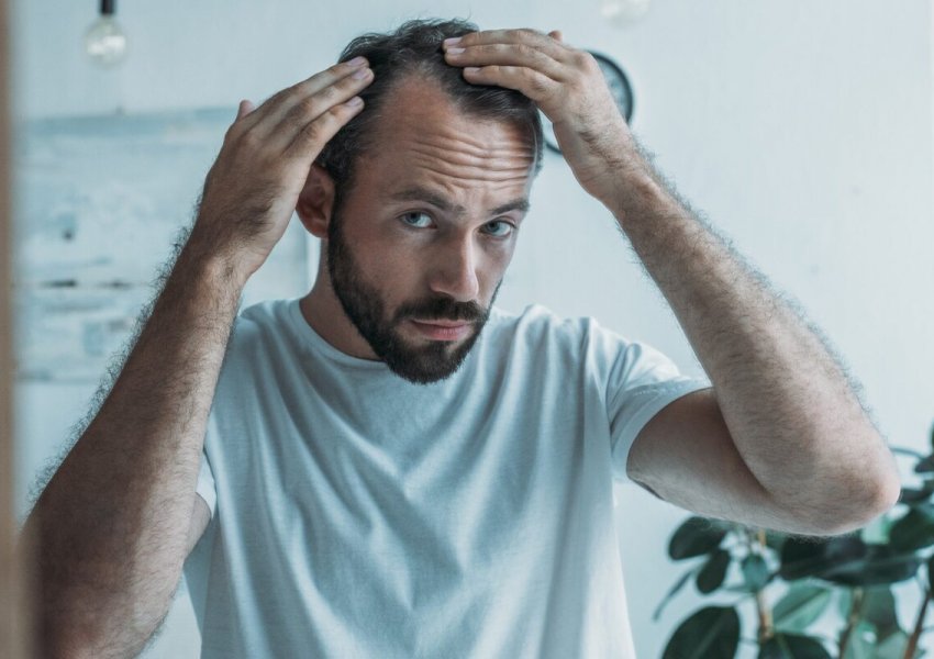 Pse jeta moderne po i bën meshkujt të humbasin flokët?