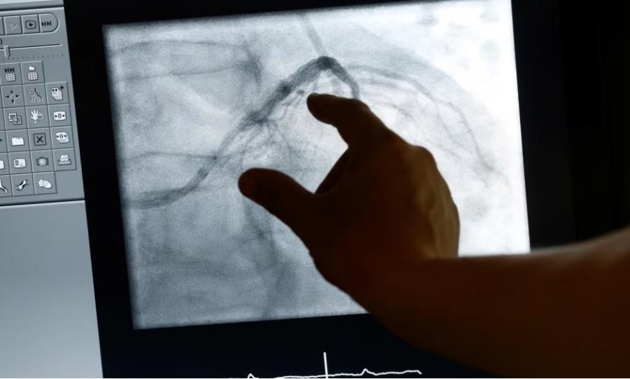 VOA/ Diagnostikimi me inteligjencën artificiale i sëmundjeve të zemrës dhe kancerit