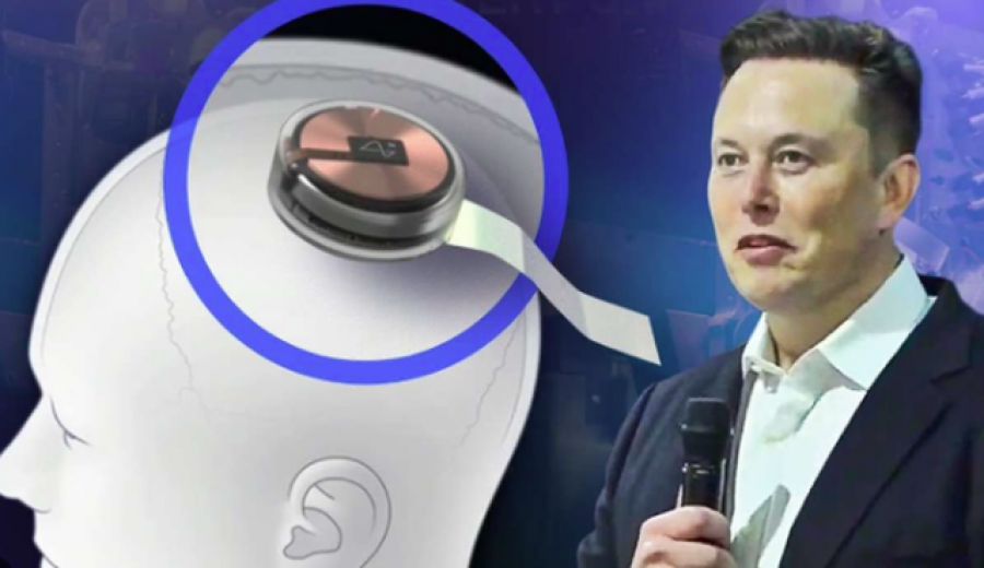 Elon Musk njofton vendosjen e çipit të parë ‘Neuralink’ te një njeri