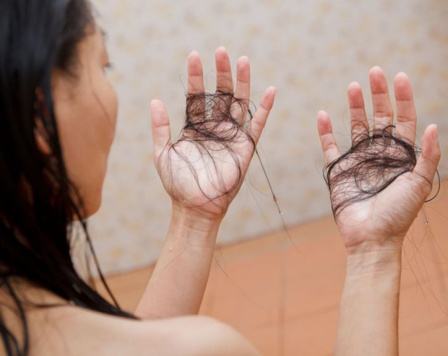 Kura më e mirë kundër hollimit dhe rënies së flokëve – Shkaqet dhe trajtimet natyrale