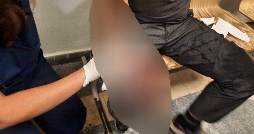 Pamje të personit që u sulmua nga qentë endacakë para Ortopedisë në Prishtinë