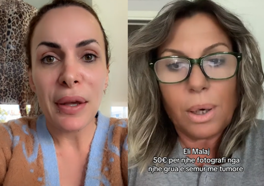 '50 euro për të bërë foto', gruaja me kancer akuzon këngëtaren, Eli Malaj: Askush nuk të ka lypur gjë