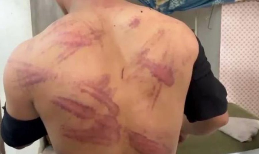 Irani dëbon 1.5 milion afganë: Akuza për spiunazh dhe trajtime çnjerëzore