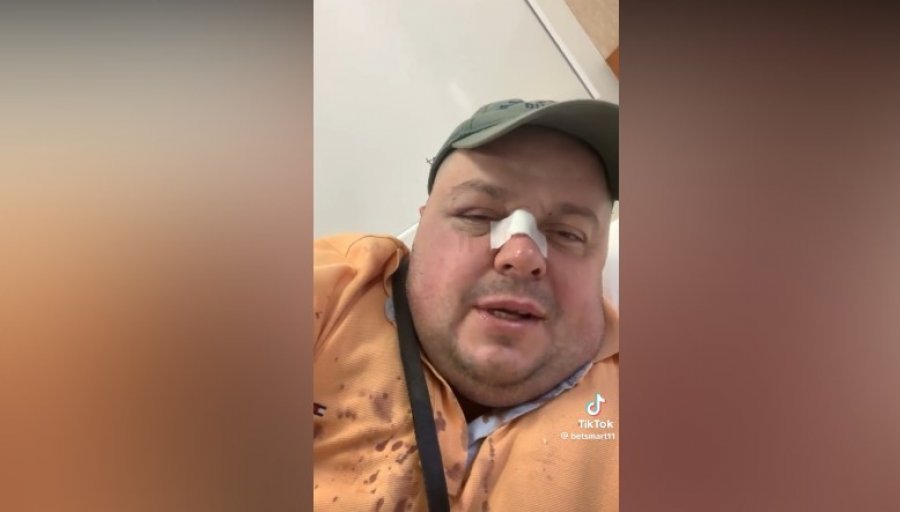 VIDEO/ ‘Bëri peshk’ Genardin dhe Paqësorin– Procedohet penalisht 40-vjeçari, e pëson edhe një 25-vjeçare