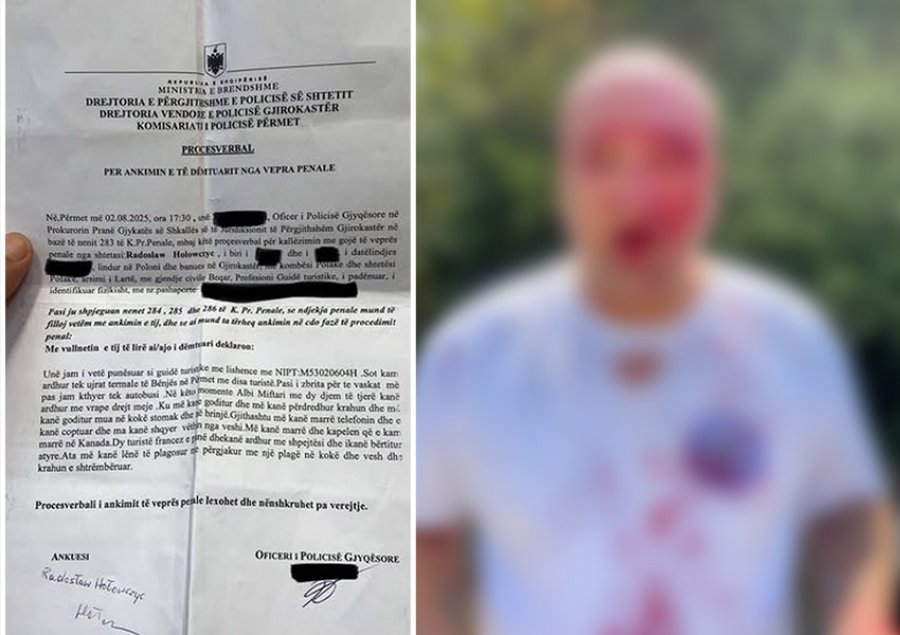 PAMJE të rënda/ Dhunohet operatori i një guide turistike polake në Përmet