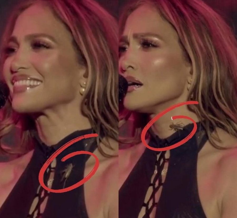 Një karkalec zvarritet në qafën e Jennifer Lopez gjatë koncertit në Almaty, reagimi i qetë i këngëtares bëhet viral