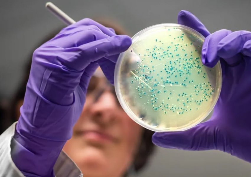 Shkencëtarët krijojnë dy antibiotikë nga inteligjenca artificiale, sfidojnë rezistencën bakteriale