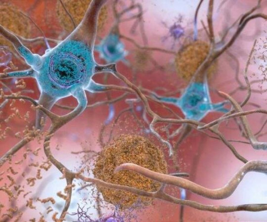 Studimi i Harvardit arrin të zhdukë simptomat e Alzheimerit për herë të parë tek minjtë